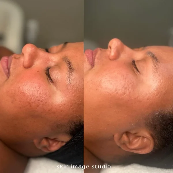 Courtesy of BioSkin Aesthetics