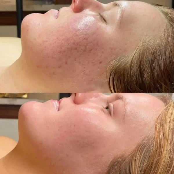 Courtesy of BioSkin Aesthetics