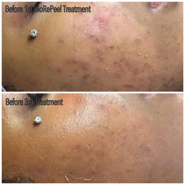 Courtesy of BioSkin Aesthetics