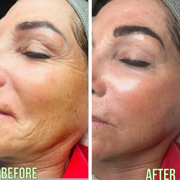 Courtesy of BioSkin Aesthetics