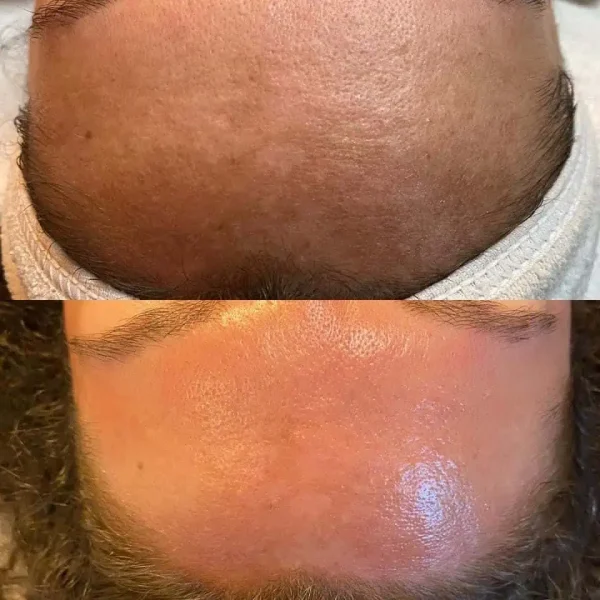 Courtesy of BioSkin Aesthetics