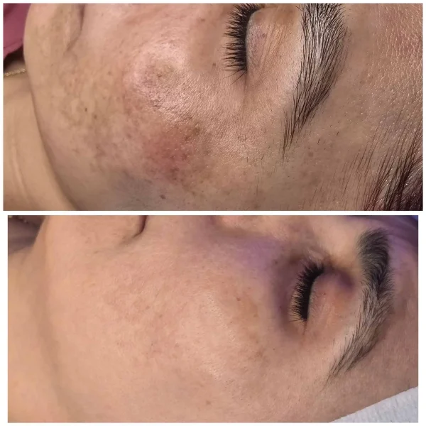 Courtesy of BioSkin Aesthetics