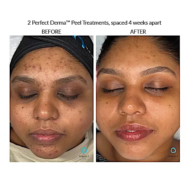 Courtersy of Bella Medical