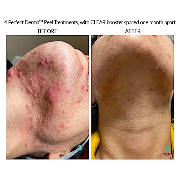 Courtersy of Bella Medical