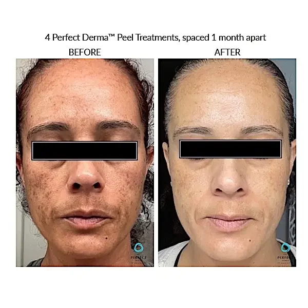 Courtersy of Bella Medical