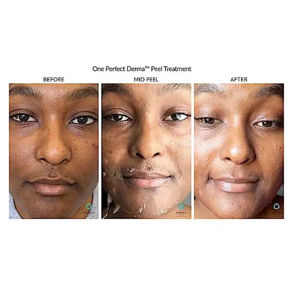 Courtersy of Bella Medical