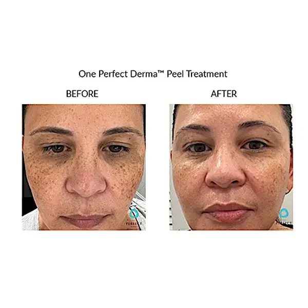 Courtersy of Bella Medical