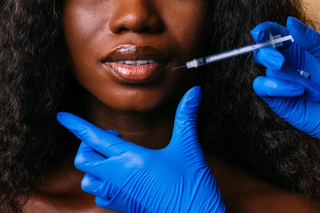 Unlocking Youthful Radiance with Dermal Filler in the Brooklyn Staten Island and Queens_a_in Brooklyn NY