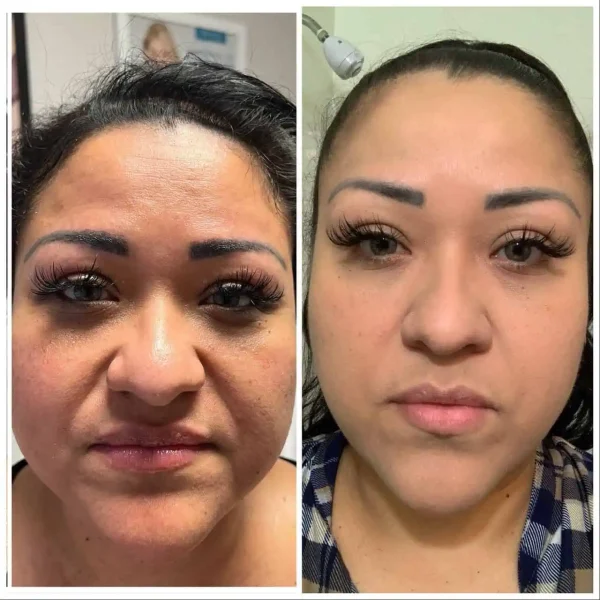 Courtesy of BioSkin Aesthetics