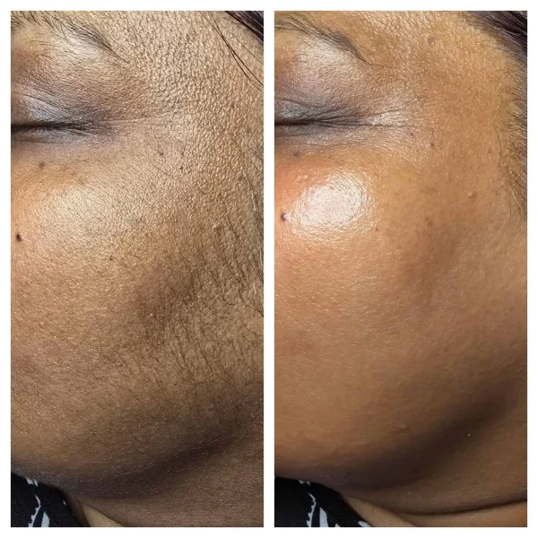 Courtesy of BioSkin Aesthetics